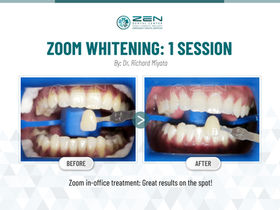Teeth Whitening Case Study | Capitol Hill Seattle WA | Zen Dental
