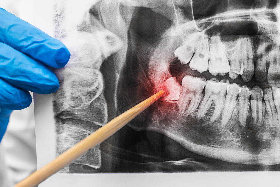 Farmington Dental Care in Beaverton, OR 97005 Implants, Family, Cosmetic Dentist - Dentist near me, Dental Checkup, Cleaning & Examinations, Crowns, Bridges, Implants, Restorations, Veneers & Laminates, Bonding, Fillings, Dentures, Partial Dentures, Teeth Whitening, Tooth Extractions, Kid Friendly Dentist, Periodontics, Root Canal Therapy, Sedation, Inlays & Onlays, Dental Sealants, Oral Cancer Screening