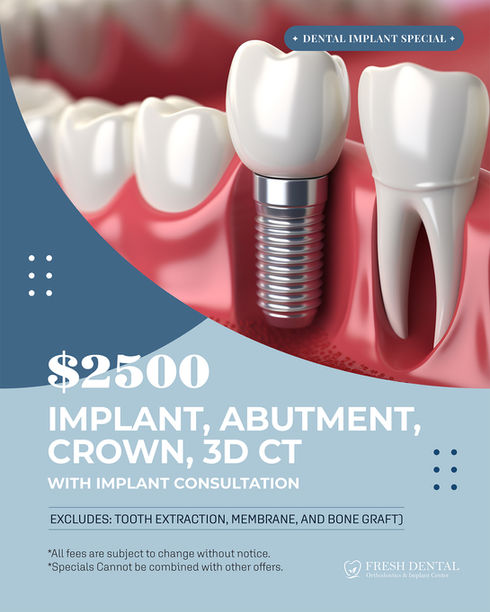 Fresh Dental Orthodontics & Implant Center in Dallas, TX 75248 - Orthodontics, Braces, Dental Implant, Cosmetic Dentistry, Family Dentistry, Emergency Dental Care, Teeth Whitening, Dental Checkups, Dental Cleaning, Fluoride Treatments, Dental Sealants, Oral Cancer Screening, Gum Disease Prevention, Invisalign, Clear Aligner, Porcelain Veneers, Smile makeover, Tooth fillings, Cosmetic Bonding, Dental Crown, Dental Bridges, Wisdom Tooth Extractions, Root Canal Therapy