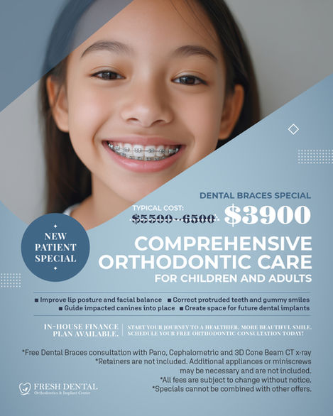 Fresh Dental Orthodontics & Implant Center in Dallas, TX 75248 - Orthodontics, Braces, Dental Implant, Cosmetic Dentistry, Family Dentistry, Emergency Dental Care, Teeth Whitening, Dental Checkups, Dental Cleaning, Fluoride Treatments, Dental Sealants, Oral Cancer Screening, Gum Disease Prevention, Invisalign, Clear Aligner, Porcelain Veneers, Smile makeover, Tooth fillings, Cosmetic Bonding, Dental Crown, Dental Bridges, Wisdom Tooth Extractions, Root Canal Therapy