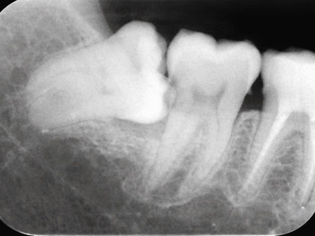Tips For Improving Your Smile In 2026