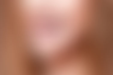 Columbia Dentist Answers FAQs About Caring for Orthodontics