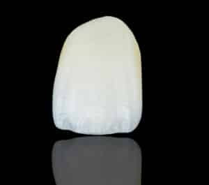 veneer