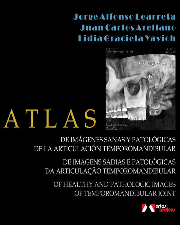Atlas of Healthy and Pathologic Images of Temporomandibular Joint