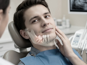 denti del giudizio sani e denti del giudizio inclusi confronto