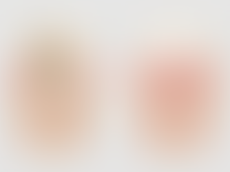 devitalizzazione dente schema semplice canali radicolari