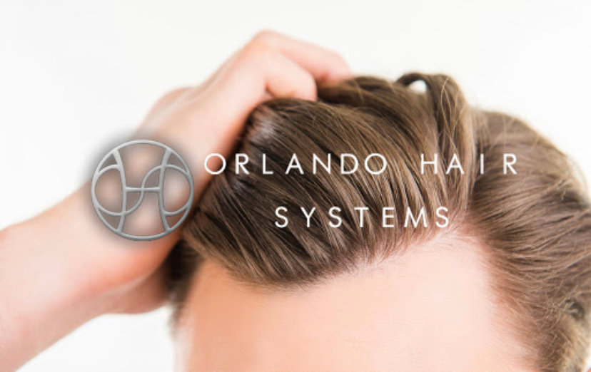 Hair replacement Systems