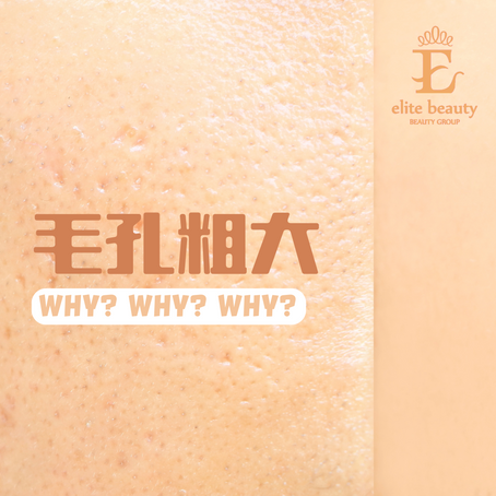 【毛孔粗大!? Why?Why?Why?】