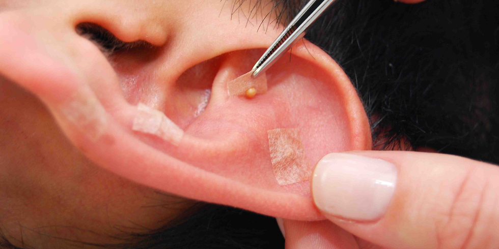 Curso de Auriculoterapia Chinesa - Vagas Esgotadas!!