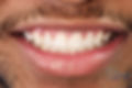 smile after