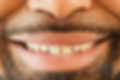 smile before