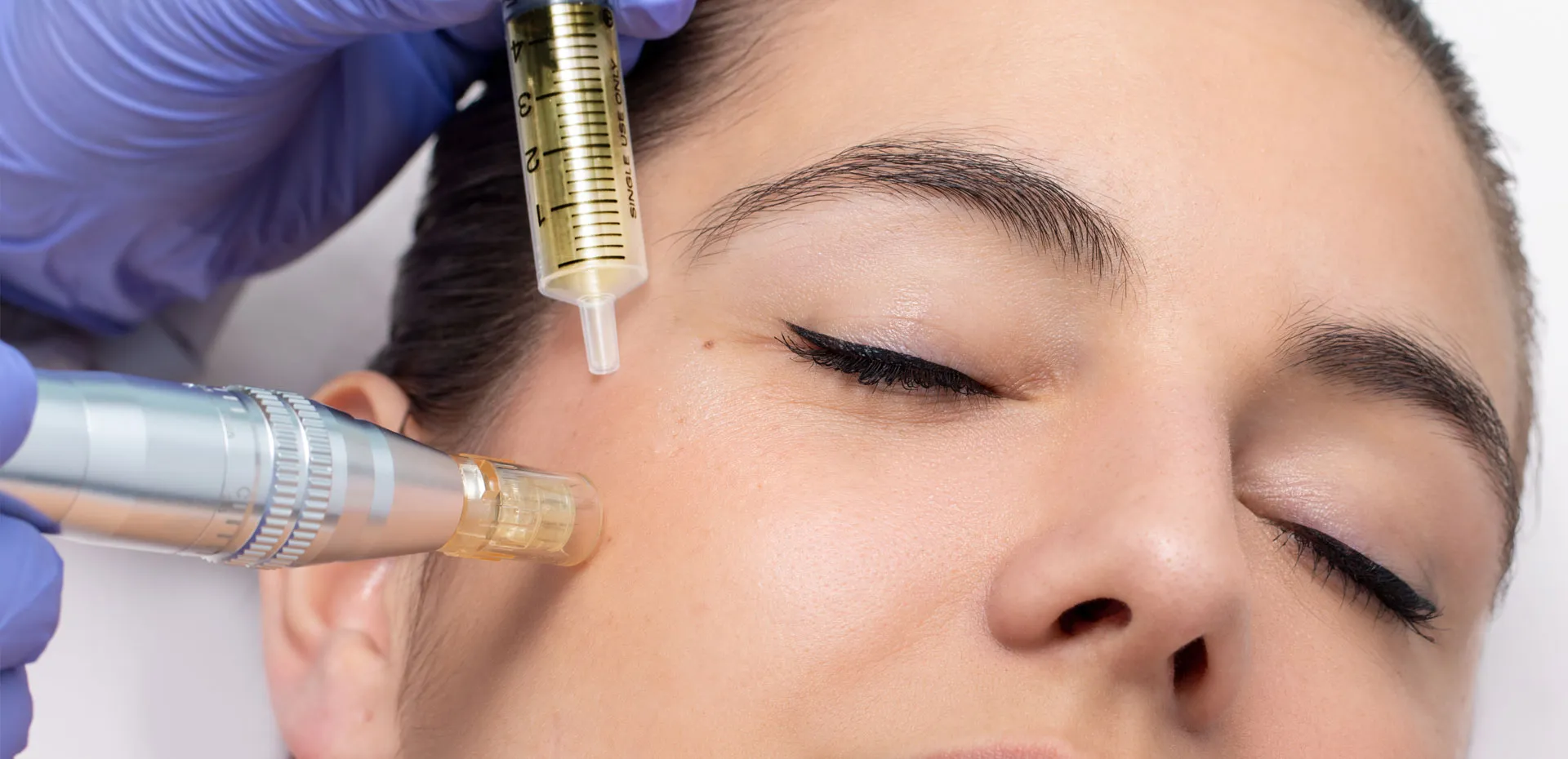 mesotherapy-2.webp