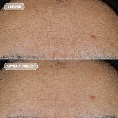 Miniature : Produkt vorher und nachher 2 IMAGE Skincare - AGELESS+ Retinol Repair Crème 0.3% Retinol Complex (50g)