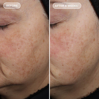 Miniature : Produkte vor und nachher Fotos Gesicht IMAGE Skincare - AGELESS+ Retinol Pure Liquid Retinol 0.3% (30ml)