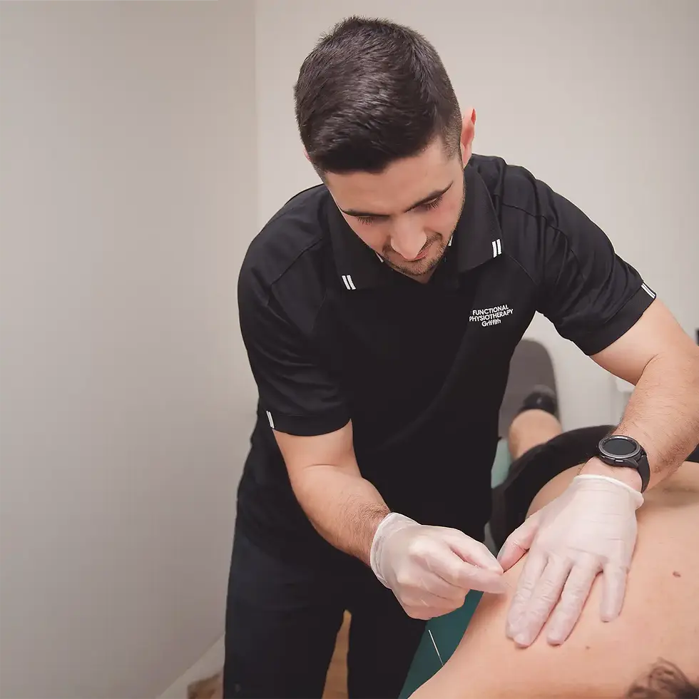 Dapto physio Chris Vitucci performing dry needling treatment for a patient