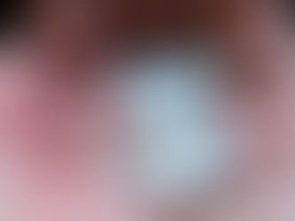 Prescrição e uso indiscriminado de benzodiazepínicos