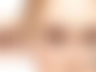A cirurgia de blefaroplastia pode gerar fibrose ou dificuldade para fechar os olhos?