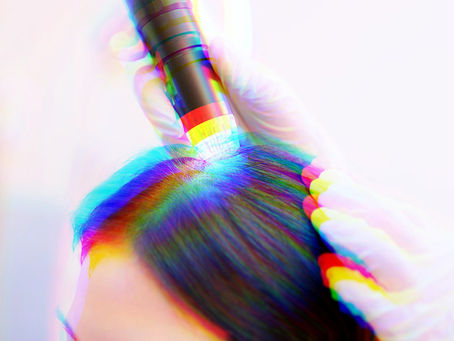An abstract, vibrant multi-colored light leak effect illuminating hair strands, symbolizing a high-tech scalp analysis or customized scalp rejuvenation treatment.