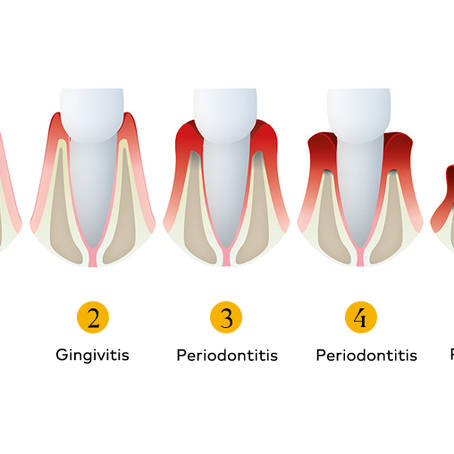 Periodoncia 