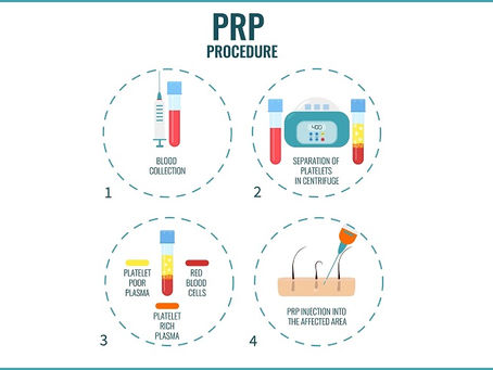 Should You Find PRP Cost for Skin and Hair Treatments?