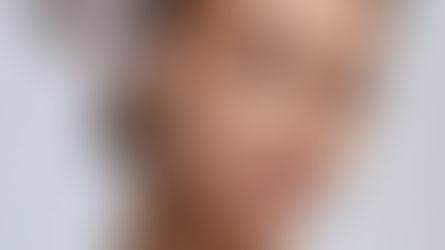 Les Fils Tenseurs : Lifting Non Chirurgical au Centre Sybays à Lausanne