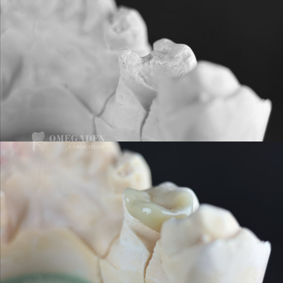 Zirconia