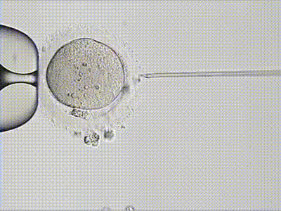 icci