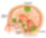 Meningioma localização