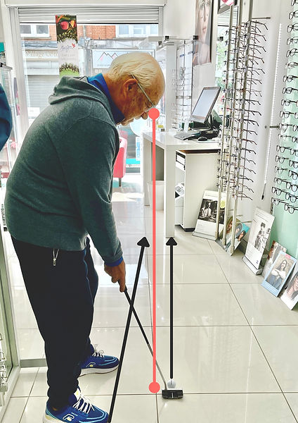 Patient A , closed stance sub optimal alignment for putting