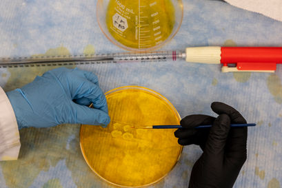 Cross sections of brain tissue are placed in a petri dish of yellow solution.