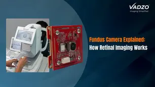 Fundus camera capturing retina, optic disc, and macula during eye examination