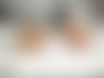 Man deciding between I-601 vs I-601A waivers