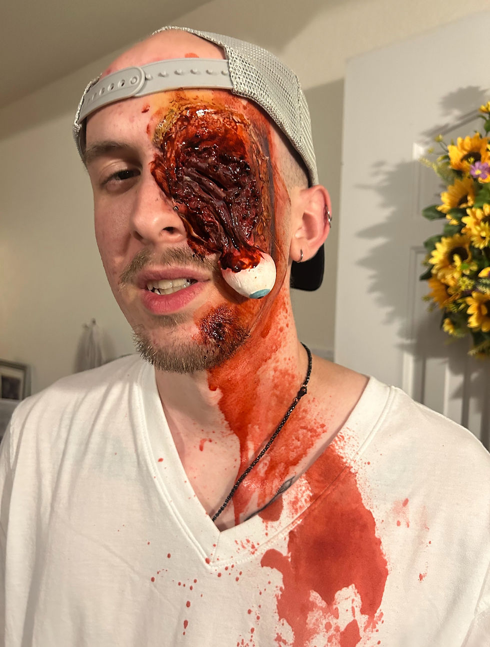 Axe Wound, Slasher Slasher