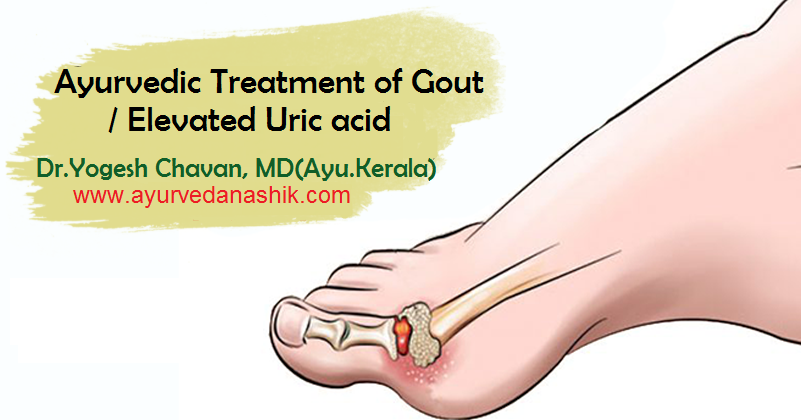 Ayurvedic treatment of gout/ elevated uric acid in Nashik