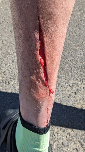 'Tis but a scratch!