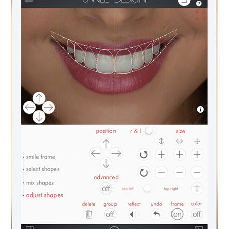 ¿Cuáles son los riesgos de un diseño de sonrisa planeado al "ojo"?