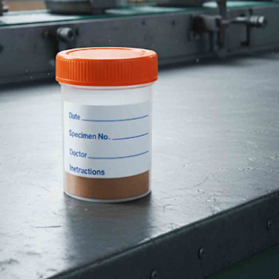 Stool containers