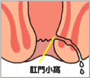 fig_anaji-min.gif