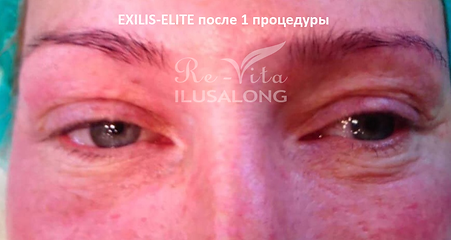 44023284_2227007080706094_6700121803206950912_n.png