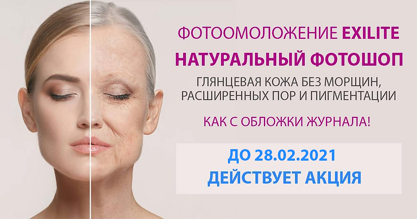 Фотоомоложение - Акция 2021.png