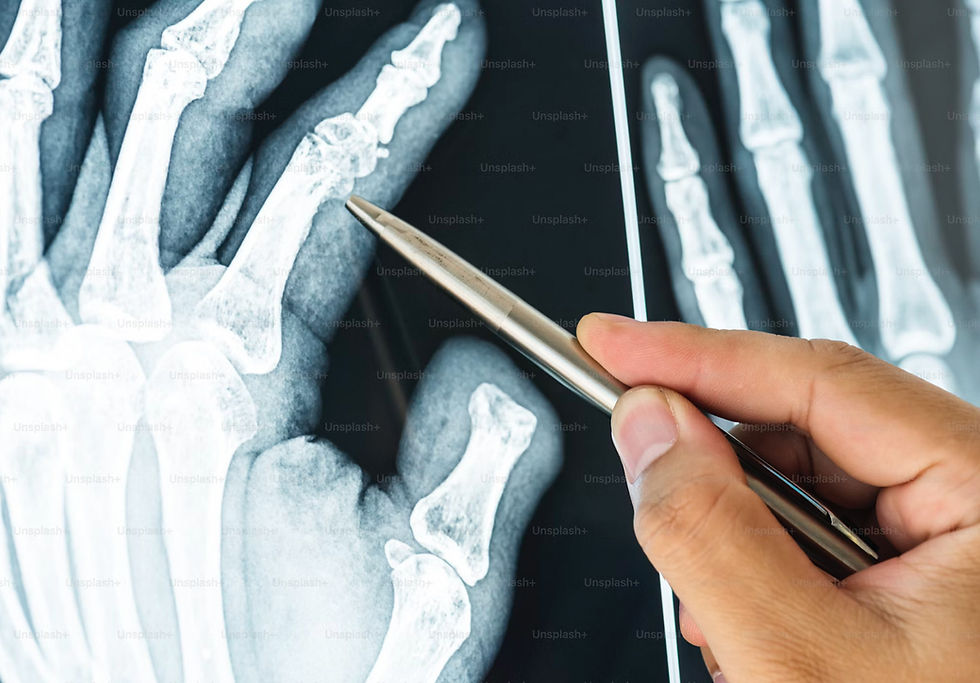 When a Workplace Injury Results in a Broken Bone — What to Do Next How Worker Care Helps You Heal, Stay Compliant, and Get Back on the Job!