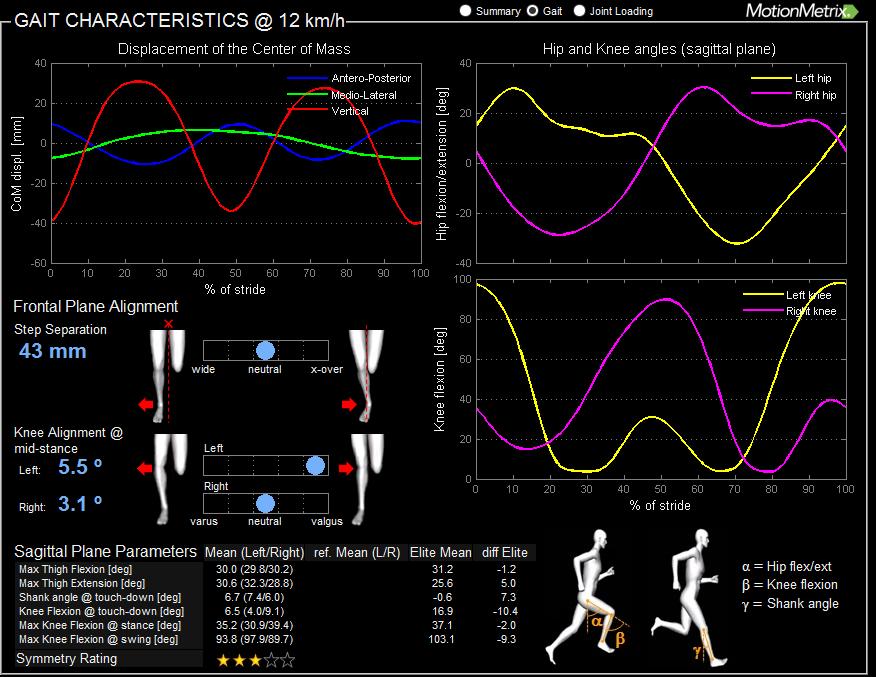 3D Gait analysis Cardiff Gait