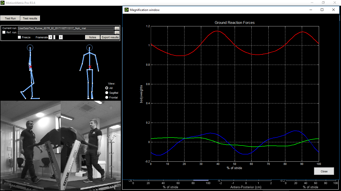 3D Gait analysis Cardiff Gait