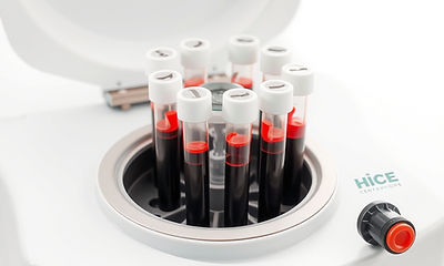 centrifuge machine with blood tubes.jpg