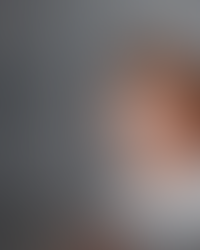 Retinoblastoma não é brincadeira