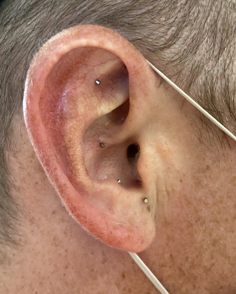 Is that a needle in your ear?? “What, I can’t hear you. There’s a