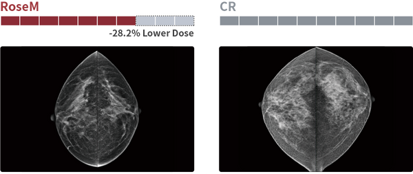 rose m vs analog.png