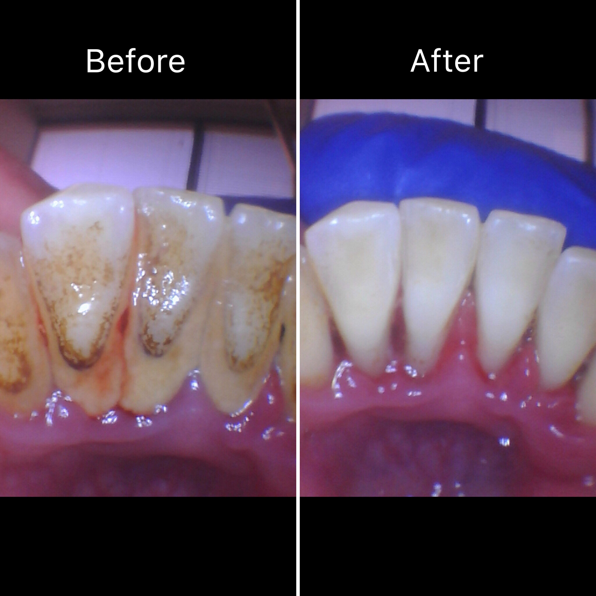 Deep Cleaning