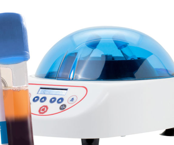 prf-natural-unmodified-blood.jpg