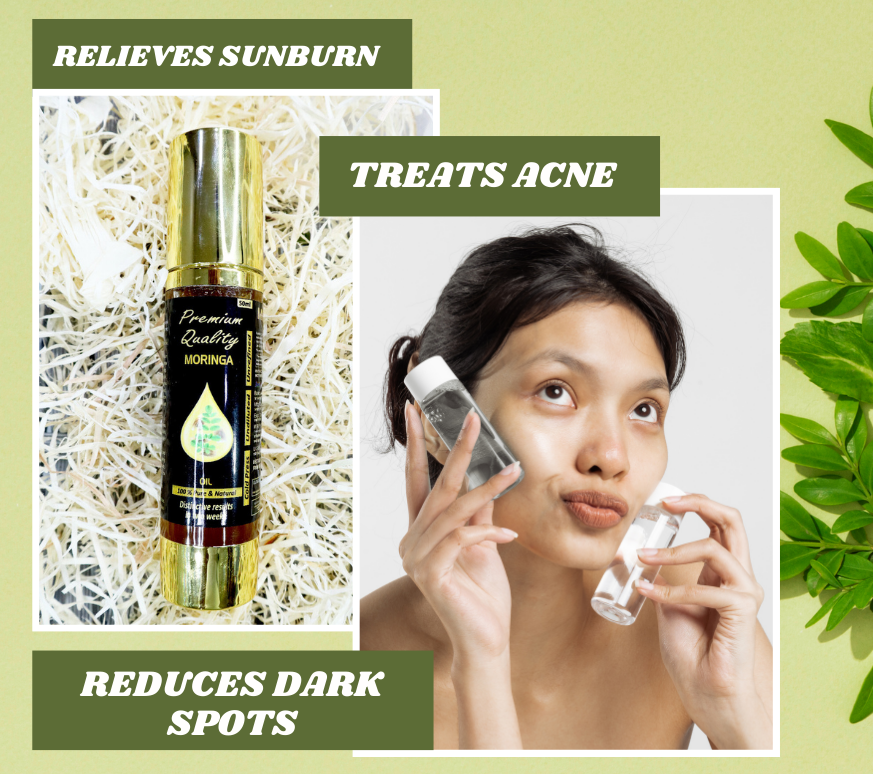 Moringa is the Ideal Solution for Acne-Prone Skin